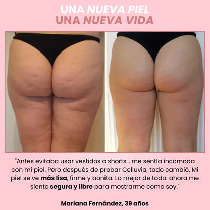 Celuvia™ Masajeador Anticelulítico