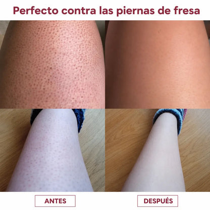 Lissia Silk Touch – Depiladora 2 en 1 para Todo el Cuerpo