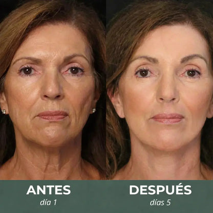 DRENYA™ Cepillo Escultor Facial