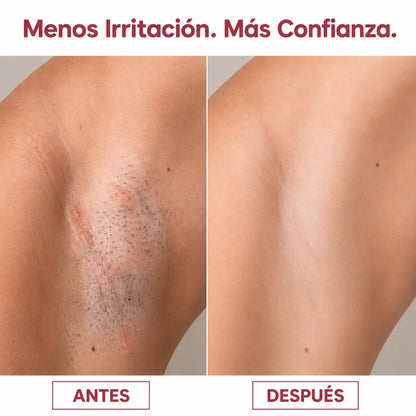 Lissia Silk Touch – Depiladora 2 en 1 para Todo el Cuerpo