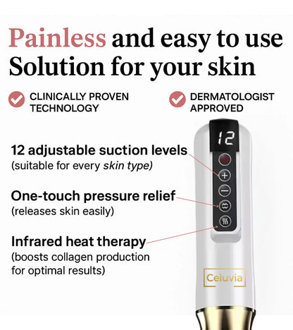 Celuvia™ Anti-Cellulite Massage Kit