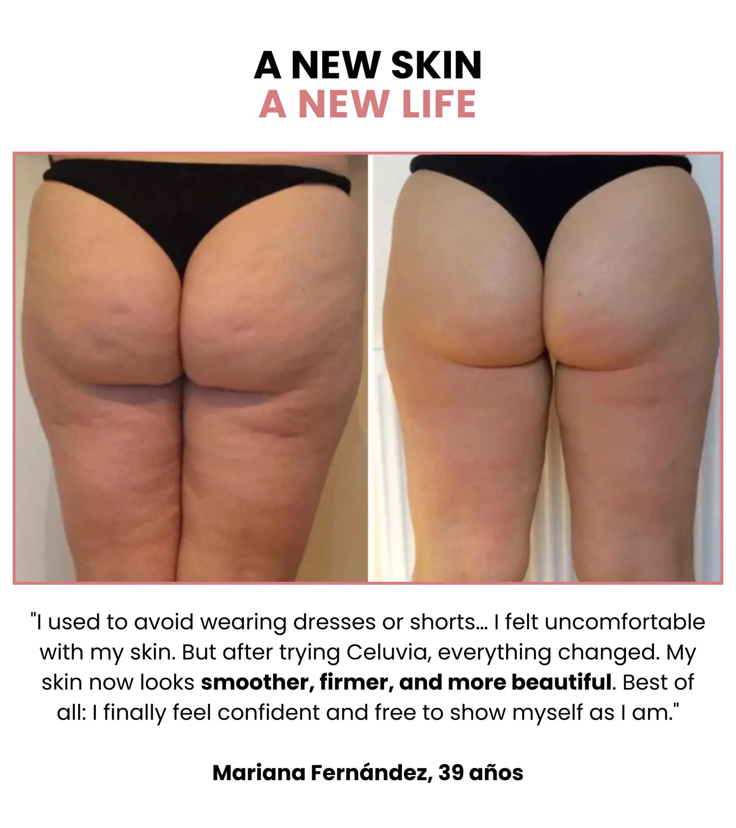 Celuvia™ Anti-Cellulite Massage Kit